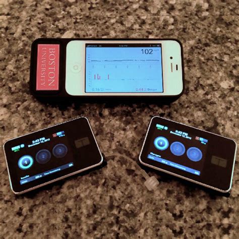 Bionic Pancreas For Type 1 Diabetes Nih Directors Blog