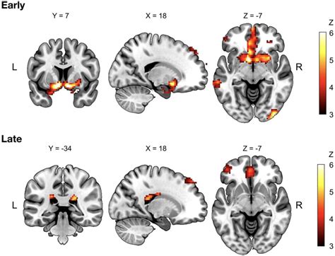 Double Dissociation Of Fmri Activity In The Caudate Nucleus Supports De