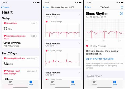 How To Use An Apple Watch Ecg