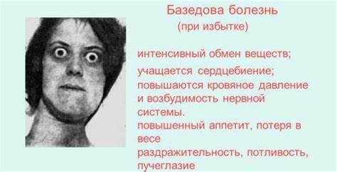 Диета при щитовидки