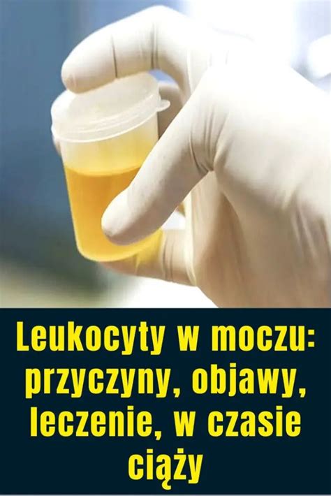 Leukocyty W Moczu Przyczyny Objawy Leczenie W Czasie Ci Y