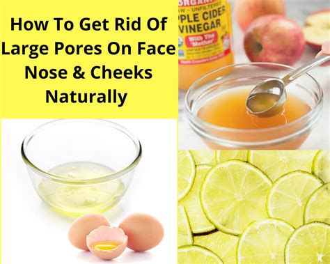 How To Get Rid Of Large Pores On Face Nose Cheeks Naturally