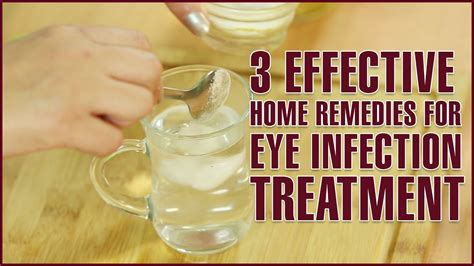 3 easy and effective home remedies for eye infection treatment youtube