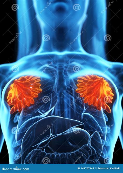 Diseased Mammary Glands Stock Illustration Illustration Of Organs