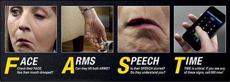 How To Recognise The Signs Of Stroke Peninsula Health