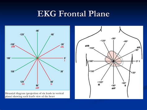 Ppt Ekg 101 Introduction Powerpoint Presentation Free Download