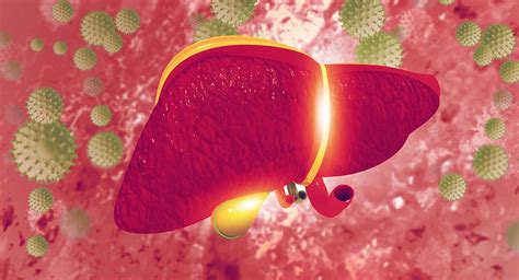 Primary Biliary Cirrhosis Symptoms Causes And Risks Ahealthguide