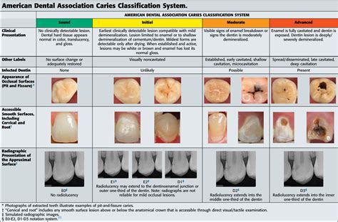 Table 3 From The American Dental Association Caries Classification
