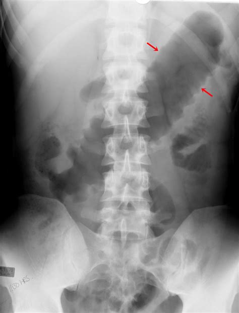 Gastrointestinal Radiology