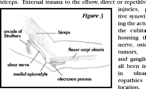 Figure 1 From Diagnosis And Treatment Of Cervical Root And Peripheral