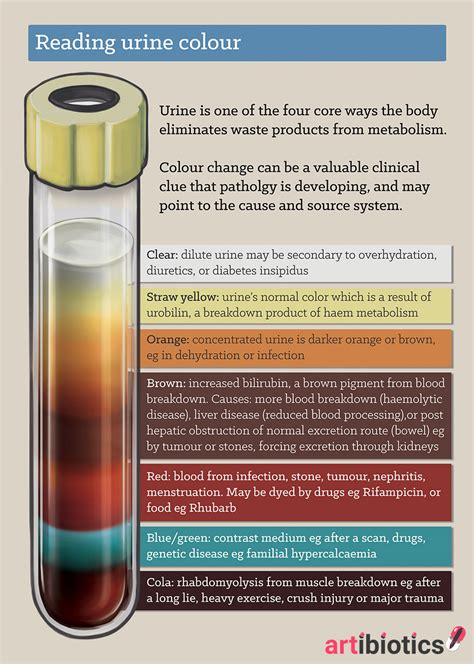 How To Read Urine Colour — Artibiotics