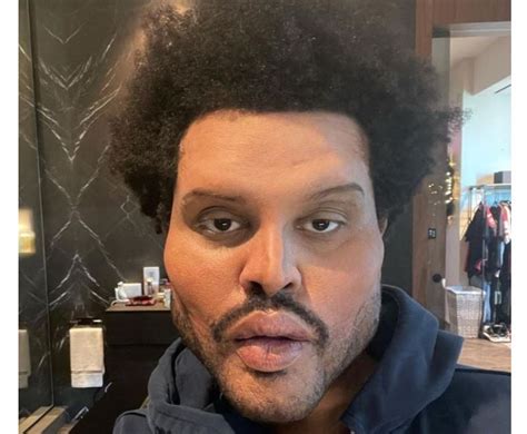 The Weeknd Shows Off Bloated Plastic Surgery Face In Freaky Music
