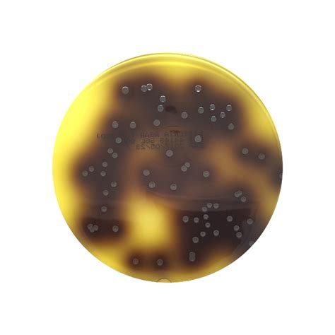 Listeria Selective Agar Oxford 90mm Plate Southern Group Laboratory