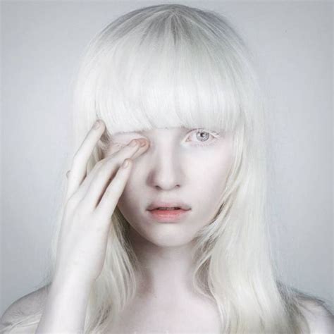 Albino Model Albinism Portrait Photography