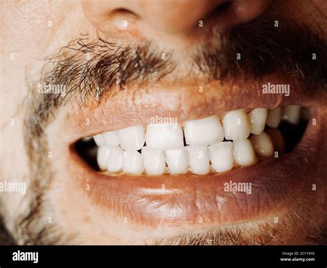 Smiling Male Mouth With White Teeth Close Up Photo Stock Photo Alamy