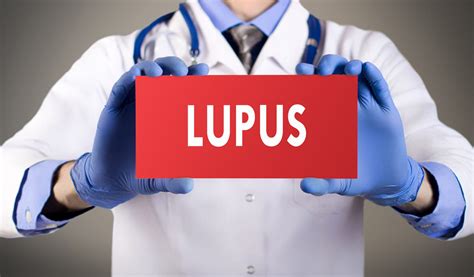 Lupus érythémateux Discoïde Définition Signes Traitement
