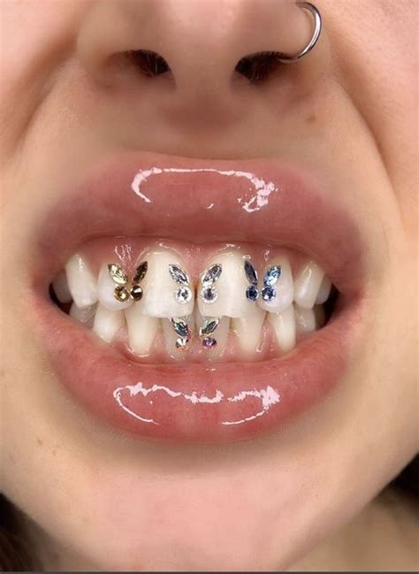 Pin By 𝙰𝚜𝚑𝚕𝚎𝚢🕊 On Accesories🤍 Teeth Jewelry Diamond Teeth Dental