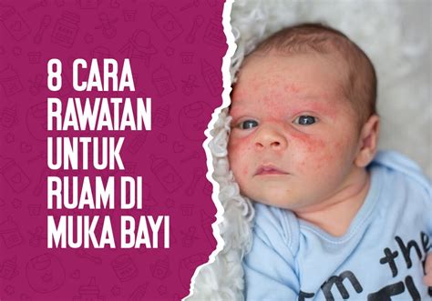 8 Cara Rawatan Untuk Ruam Di Muka Bayi Emergency Baby Care Youbaby