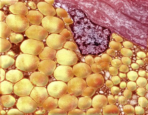Human Fat Cells Photograph By David M Phillips