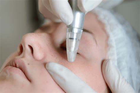 Microdermabrasion 7q Spa Laser And Aesthetics Med Spa