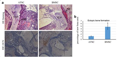 Ectopic Bone Formation Of ATSCs And BMSCs In Nude Mice A ATSCs And Download Scientific
