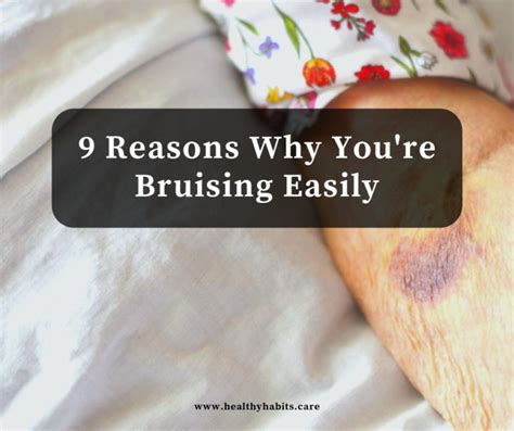 9 Reasons Why Youre Bruising Easily Healthy Habits