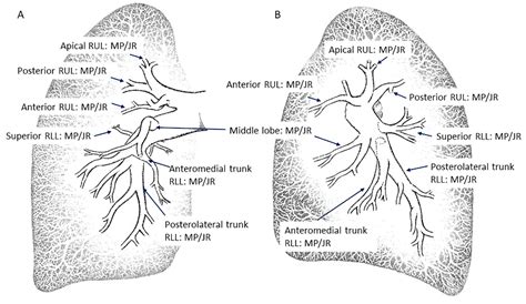 Pulmonary Artery Anatomy