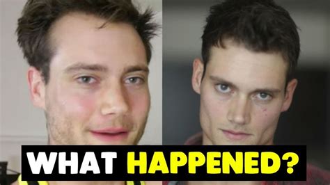 It can affect your pet's skin and its endocrine system, lymphatic system, and immune system. Response to Connor Murphy Hair Loss - YouTube