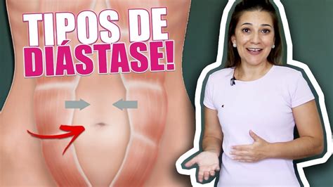 diástase tipos de barriga e diástase descubra se você tem e a sua localização youtube