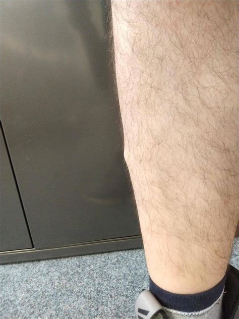 Whats This Soft Bump On Right Leg That Only Comes Out When I Put