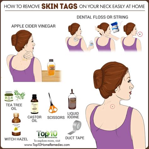 5 Home Remedies For Skin Tags Tea Tree Oil Acv And More Skin Tag