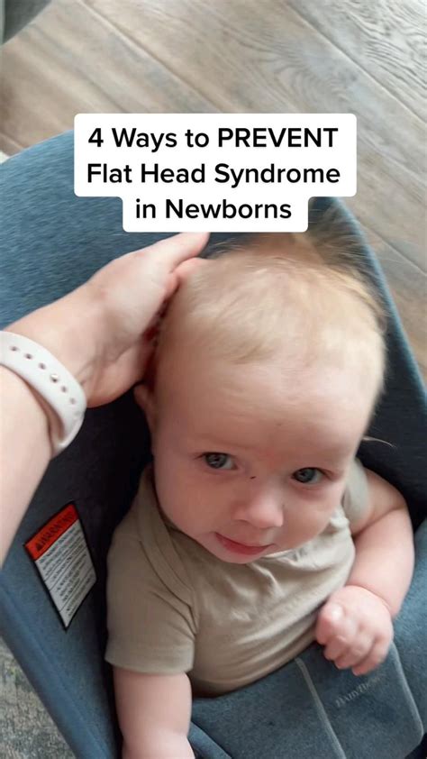 4 Ways To Prevent Flat Head Syndrome Positional Plagiocephaly In