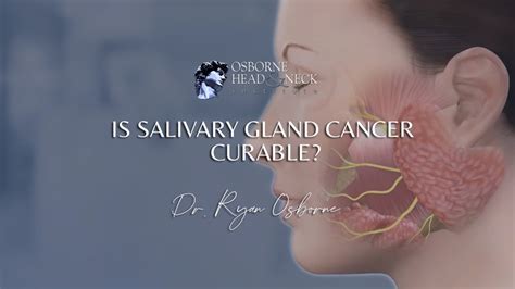 Is Salivary Gland Cancer Curable Youtube