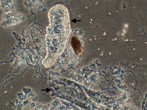 Floc Characterization And Filamentous Bacteria Identification