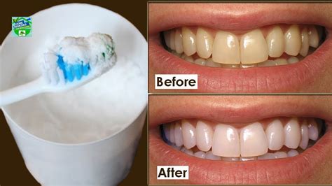 4 Simple Natural Ways To Whiten Your Teeth At Home Youtube