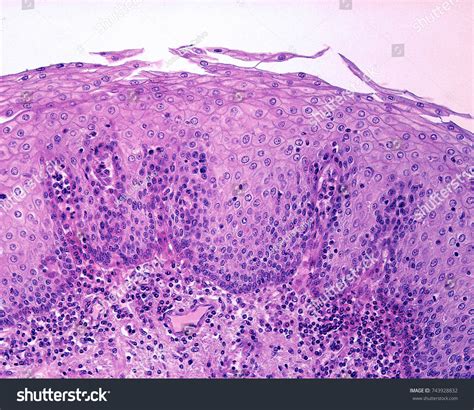 Epithelial Lining Esophagus Nonkeratinized Stratified Squamous Foto