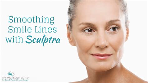 Smoothing Smile Lines With Sculptra