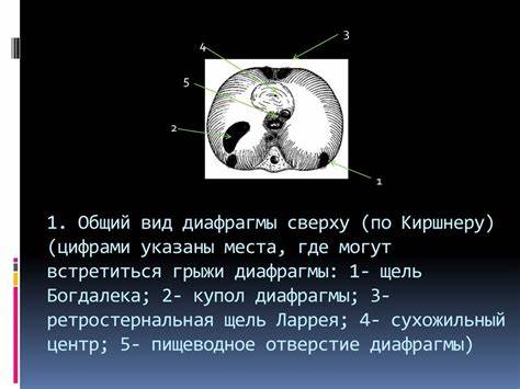 Диета для грыжи диафрагмы Диафрагмальные грыжи у детей - online presentation Диафрагмальные грыжи у детей - online presentation Диета для грыжи диафрагмы