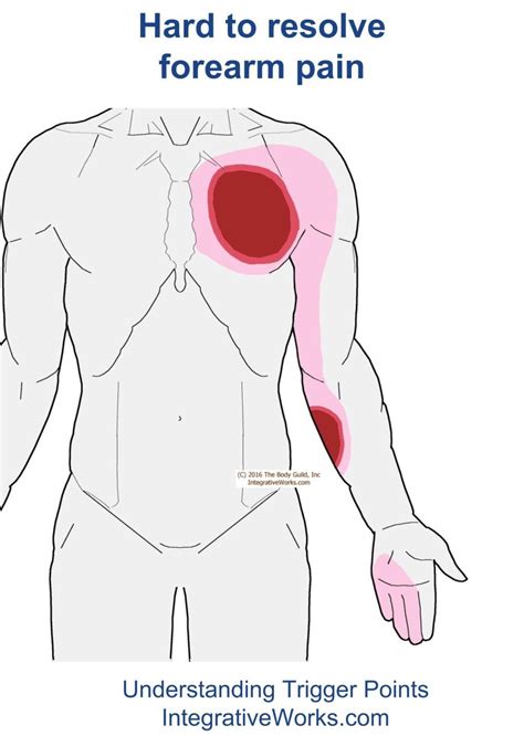 Pin On Chest Trigger Point Pain