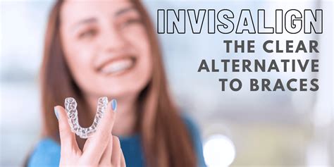 Invisalign Aligners Treatment Costs And Why You Should Get Them