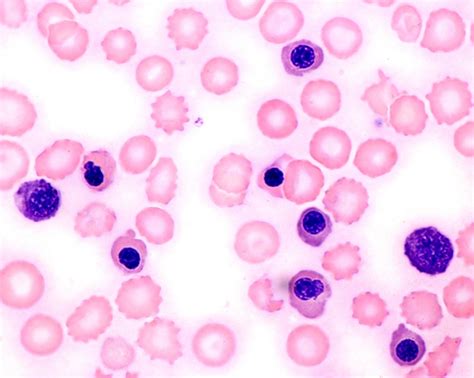 What Are Nucleated Red Blood Cell Nrbc