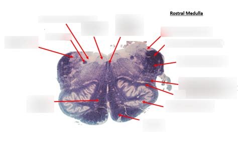 Rostral Medulla Diagram Quizlet