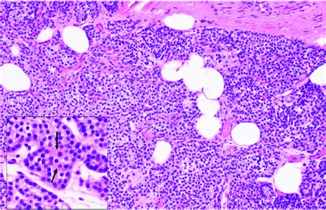 Histological Appearance Of The Normal Parathyroid Gland The Gland Is