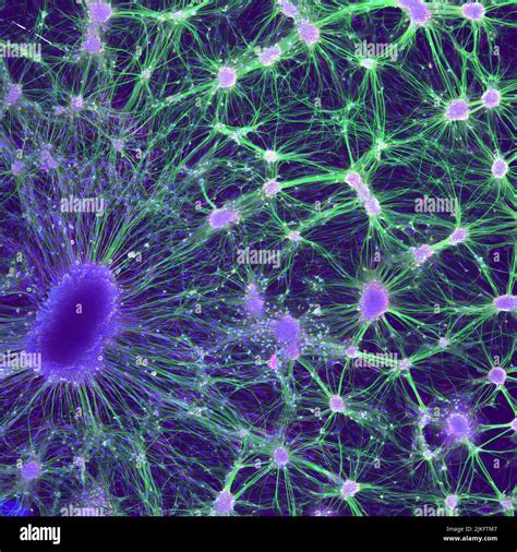 Neurona Motora Inferior Fotografías E Imágenes De Alta Resolución Alamy