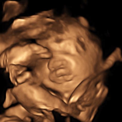 30 Weeks Pregnant 4d Ultrasound Sekarhino