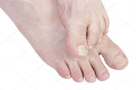 Itching Between Toes Ph