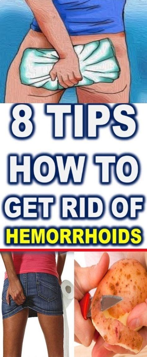 Hemorrhoids Comprehensive Summary Covers Signs Triggers And Therapy Of This Occasionally