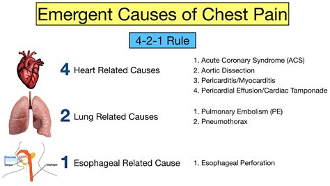 Chest Pain Causes Easy Trick To Not Miss An Emergency — Ezmed