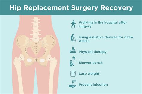Hip Replacement Recovery Tips From Doctors And Patients