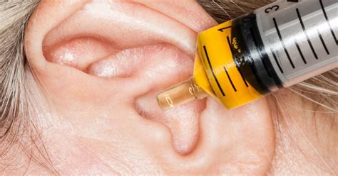 Why Does My Ear Feel Clogged Home Remedies For Wax And More